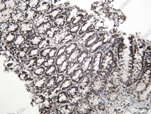 Recombinant EWS Monoclonal Antibody - 4
