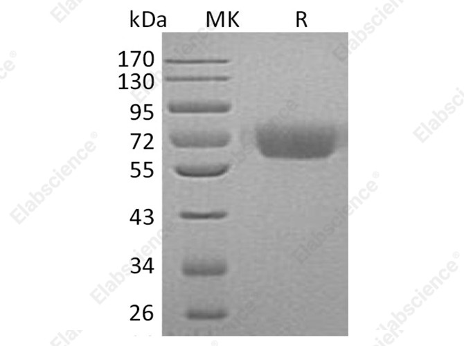 Recombinant Human Kininogen 1/KNG1 Protein (His Tag) - 1