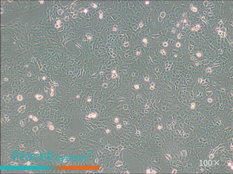 B-CPAP [BC-PAP; BCPAP] Cell Complete Medium - 2