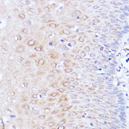 Immunohistochemistry of paraffin-embedded Human esophageal using Polyclonal AntibodyPC1 Polyclonal Antibody at dilution of  1:100 (40x lens).