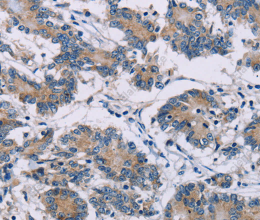 ODF2 Polyclonal Antibody - 2