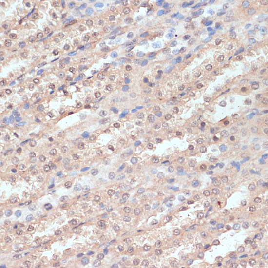 Immunohistochemistry of paraffin-embedded rat kidney using NAA20 Polyclonal Antibody at dilution of 1:100 (40x lens).Perform microwave antigen retrieval with 10 mM PBS buffer pH 7.2 before commencing with IHC staining protocol.