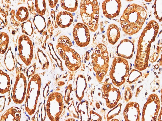 Immunohistochemistry of paraffin-embedded Human kidney using S100A9 Polyclonl Antibody at dilution of 1:200.