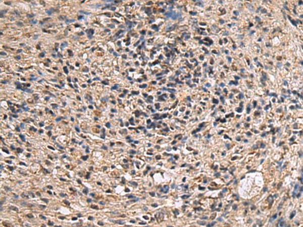 Immunohistochemistry of paraffin-embedded Human brain tissue  using ITIH2 Polyclonal Antibody at dilution of 1:70(?200)