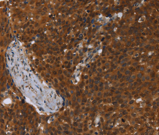 MCHR1 Polyclonal Antibody - 3