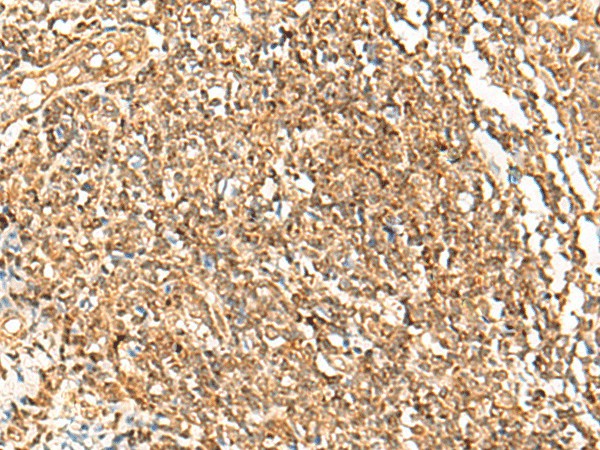 Immunohistochemistry of paraffin-embedded Human tonsil tissue  using POLH Polyclonal Antibody at dilution of 1:45(?200)