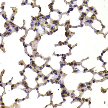 Immunohistochemistry of paraffin-embedded Mouse lung using TXN Polyclonal Antibody at dilution of  1:100 (40x lens).