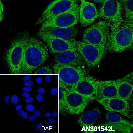 Recombinant GRP94 Monoclonal Antibody - 2