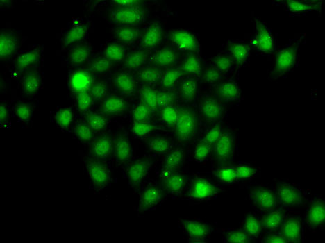 Immunofluorescence analysis of A-549 cells using COPS2 Polyclonal Antibody