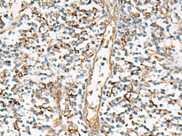 Immunohistochemistry of paraffin-embedded Human tonsil tissue  using NPC2 Polyclonal Antibody at dilution of 1:80(?200)