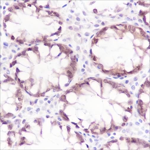 Recombinant Caspase-7 Monoclonal Antibody - 3