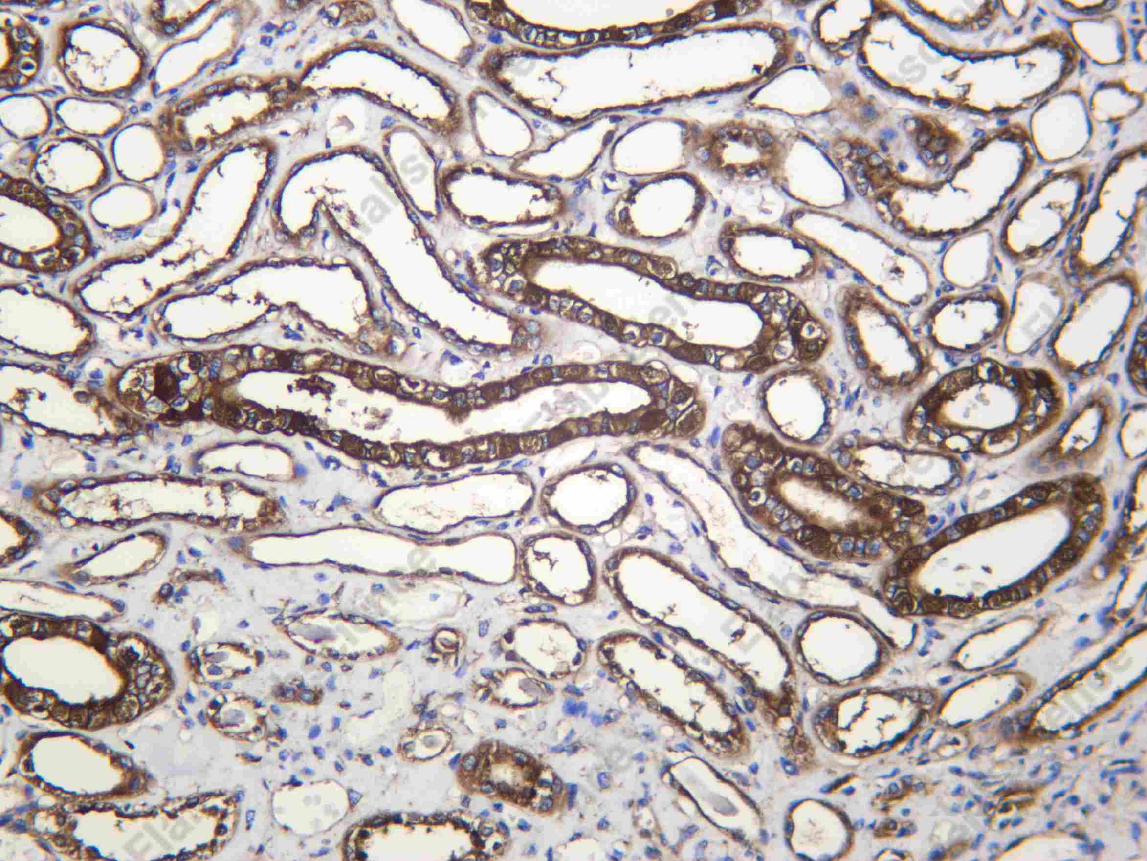 Recombinant VATA Monoclonal Antibody - 1