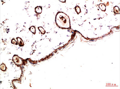 Immunohistochemistry of paraffin-embedded Rat skin tissue using PDGFRA Monoclonal Antibody at dilution of 1:200.