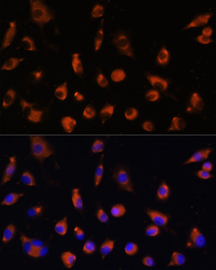 Immunofluorescence analysis of L929 cells using TMEM25 Polyclonal Antibody at dilution of  1:100. Blue: DAPI for nuclear staining.