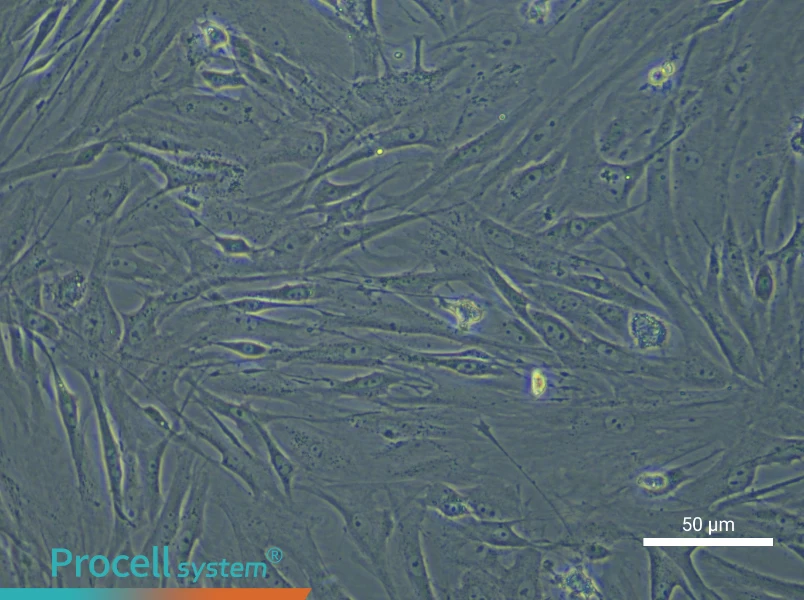 Mouse Adipose-derived Mesenchymal Stem Cells - 6