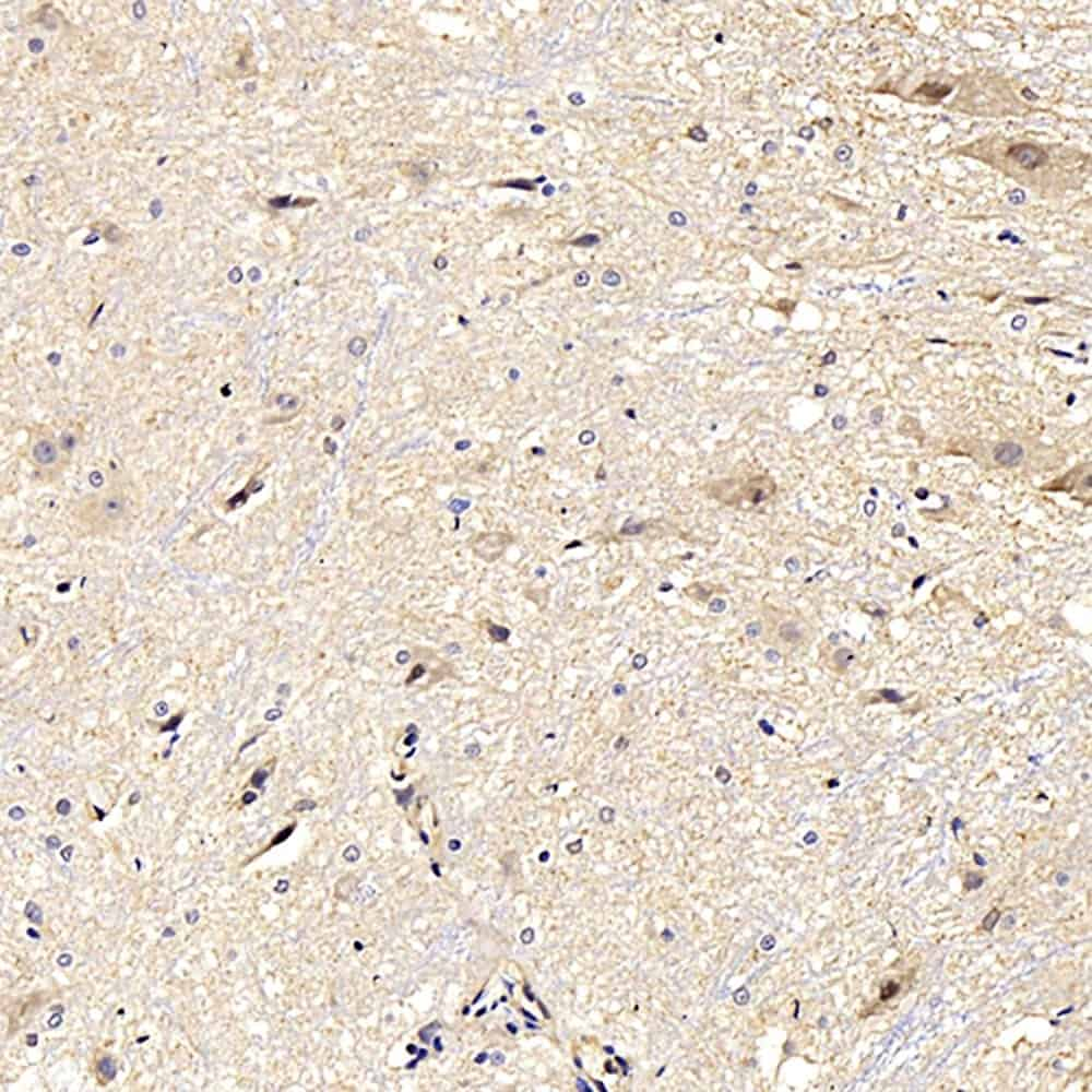 Immunohistochemistry analysis of paraffin-embedded rat spinal marrow  using NOS2 Polyclonal Antibody at dilution of 1:500.