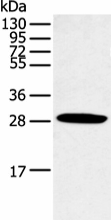 Western blot analysis of Human normal lung tissue  using CLDN25 Polyclonal Antibody at dilution of 1:250