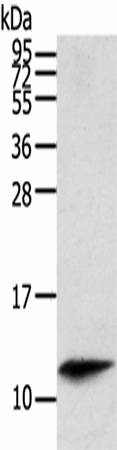 Western Blot analysis of Mouse spleen tissue using PBOV1 Polyclonal Antibody at dilution of 1/200