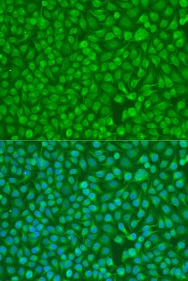 Immunofluorescence analysis of U2OS cells using CHEK1 Polyclonal Antibody at dilution of  1:100. Blue: DAPI for nuclear staining.