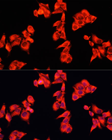 Immunofluorescence analysis of HeLa cells using RhoGAP Polyclonal Antibody at dilution of 1:100. Blue: DAPI for nuclear staining.