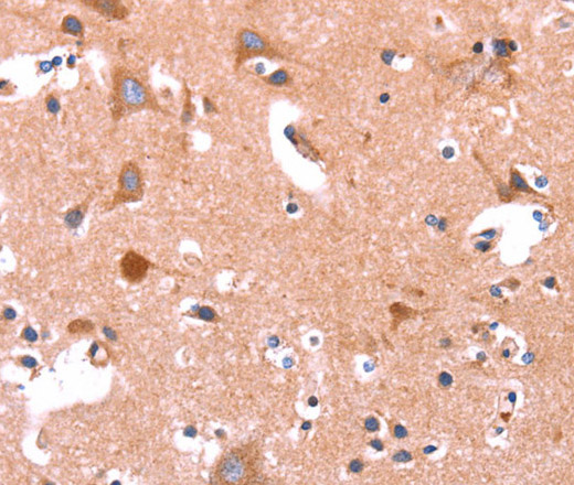 Immunohistochemistry of paraffin-embedded Human brain  tissue using ABI1 Polyclonal Antibody at dilution 1:40