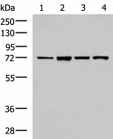 Western blot analysis of Jurkat cell Mouse liver tissue HepG2 cell Mouse kidney tissue lysates  using ZAP70 Polyclonal Antibody at dilution of 1:800