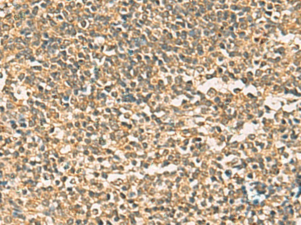 Immunohistochemistry of paraffin-embedded Human tonsil tissue  using THG1L Polyclonal Antibody at dilution of 1:50(?200)