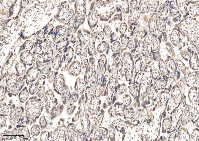 IGSF3 Monoclonal Antibody - 1