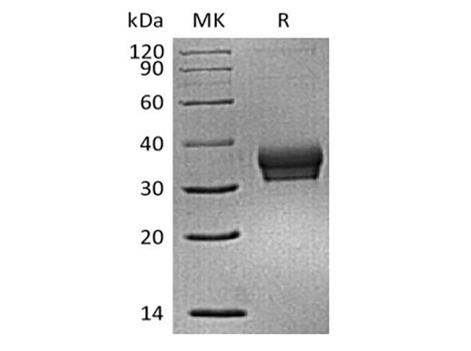 Immobilized Mouse Siglec-15-His (Cat#PKSM041394) at 2ug/ml (100 ul/well) can bind Anti-Human Siglec15 mAb. The ED50 of Anti-Human Siglec15 mAb is 27.7 ng/ml.