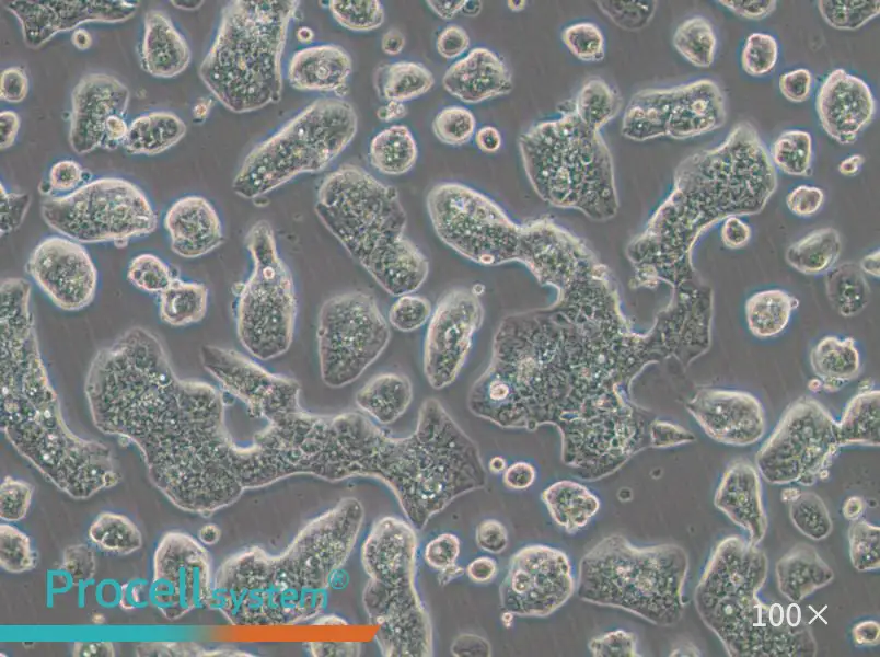 NCI-H1781 Cell Complete Medium - 1