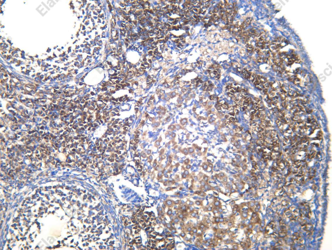 Recombinant SFRP4 Monoclonal Antibody - 2