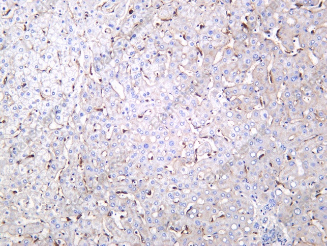 Recombinant FCGRT Monoclonal Antibody - 1