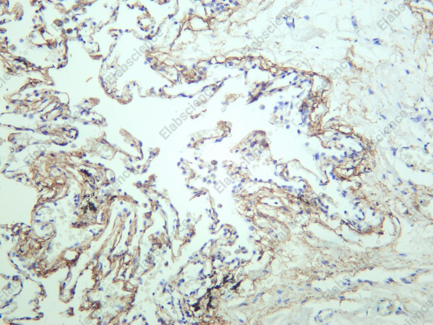 Recombinant PLCG1 Monoclonal Antibody - 4