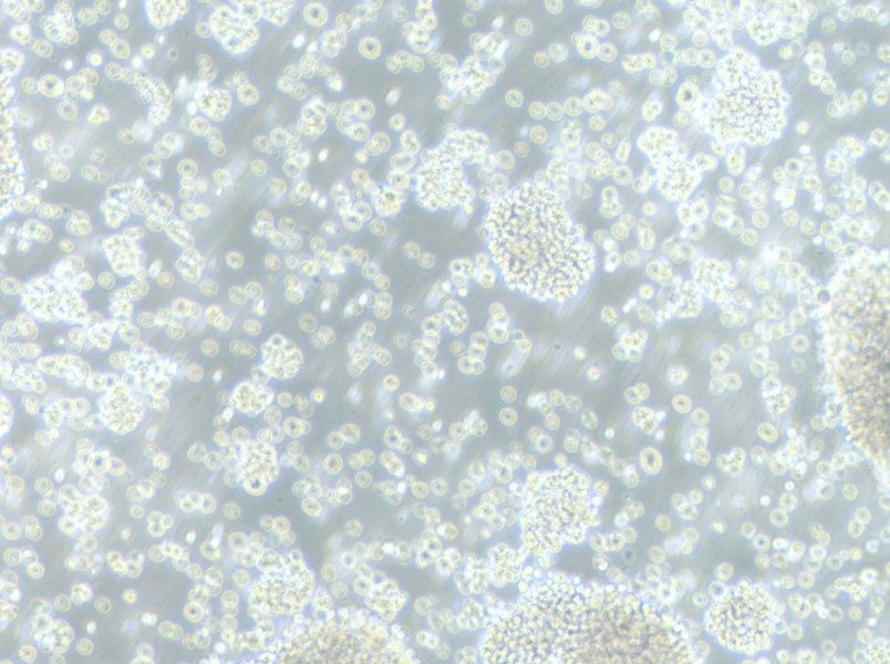 P3HR-1 Cell Complete Medium - small - 9