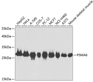 Western blot analysis of extracts of various cell lines using PSMA6 Polyclonal Antibody at dilution of 1:1000.