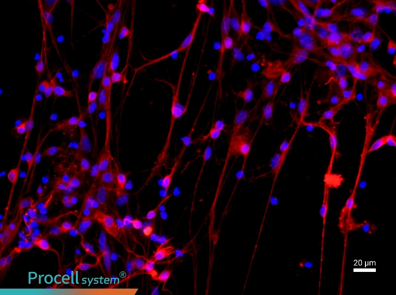 Mouse Cortical NeuronsMouse Cortical Neurons - 2