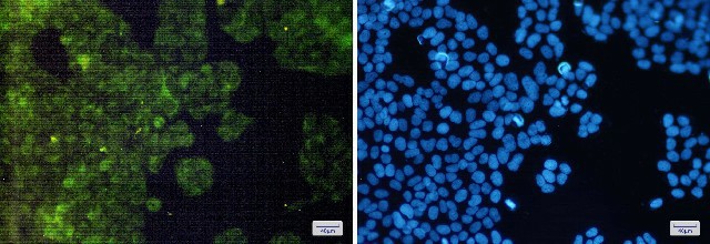 Immunofluorescence of AdSS 2(green) in Hela cells using AdSS 2 Rabbit mAb at dilution 1:200, and DAPI(blue)