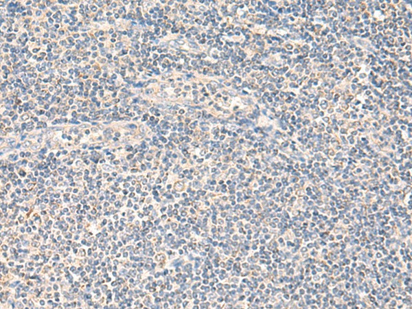 Immunohistochemistry of paraffin-embedded Human tonsil tissue  using NEGR1 Polyclonal Antibody at dilution of 1:90(?200)