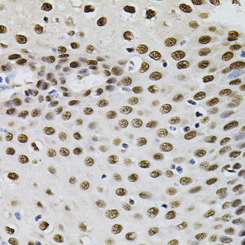 Immunohistochemistry of paraffin-embedded human esophagus using GTF2I Polyclonal antibody (40x lens).Perform microwave antigen retrieval with 10 mM PBS buf