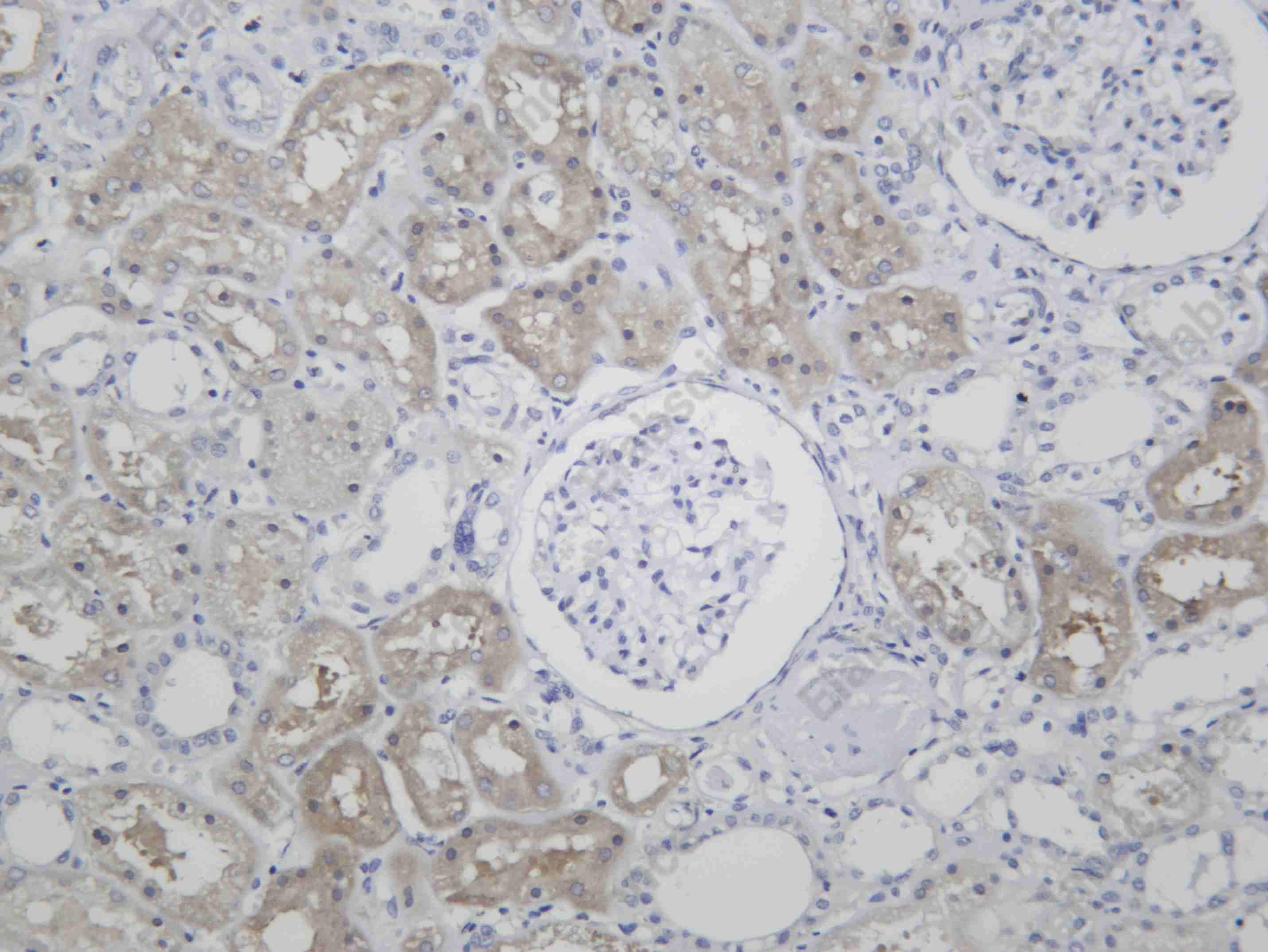 Recombinant MTHFR Monoclonal Antibody - 1
