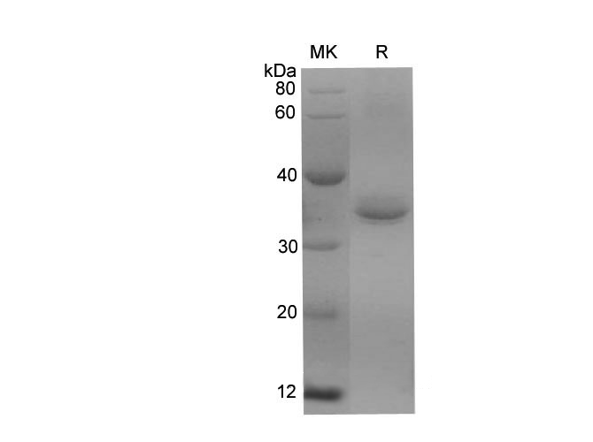 Recombinant Human CD59 Protein(His Tag)-产品推荐-1
