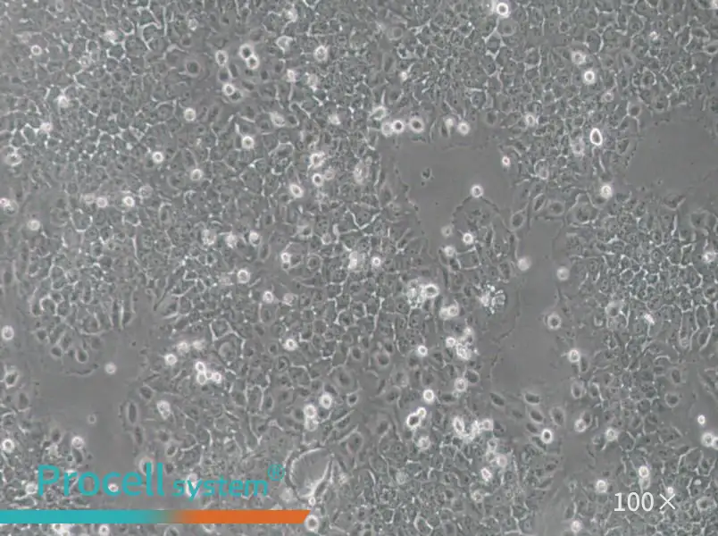 SACC-83 Cell Complete Medium - 3
