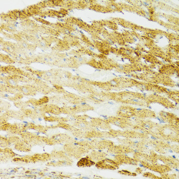 Immunohistochemistry of paraffin-embedded Mouse heart using HSPA9 Polyclonal Antibody at dilution of 1:100 (40x lens).