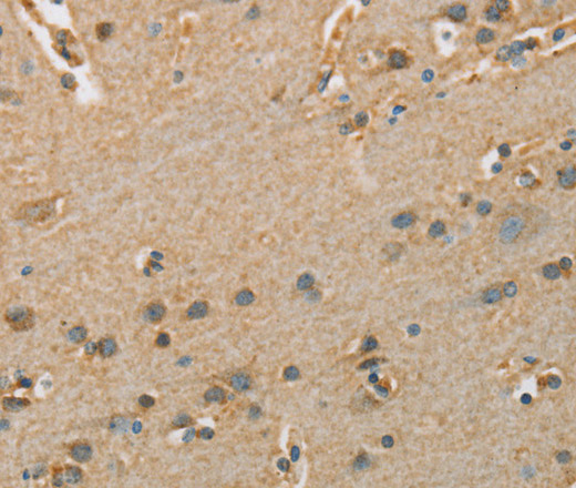 Immunohistochemistry of paraffin-embedded Human brain  tissue using ARSA Polyclonal Antibody at dilution 1:50