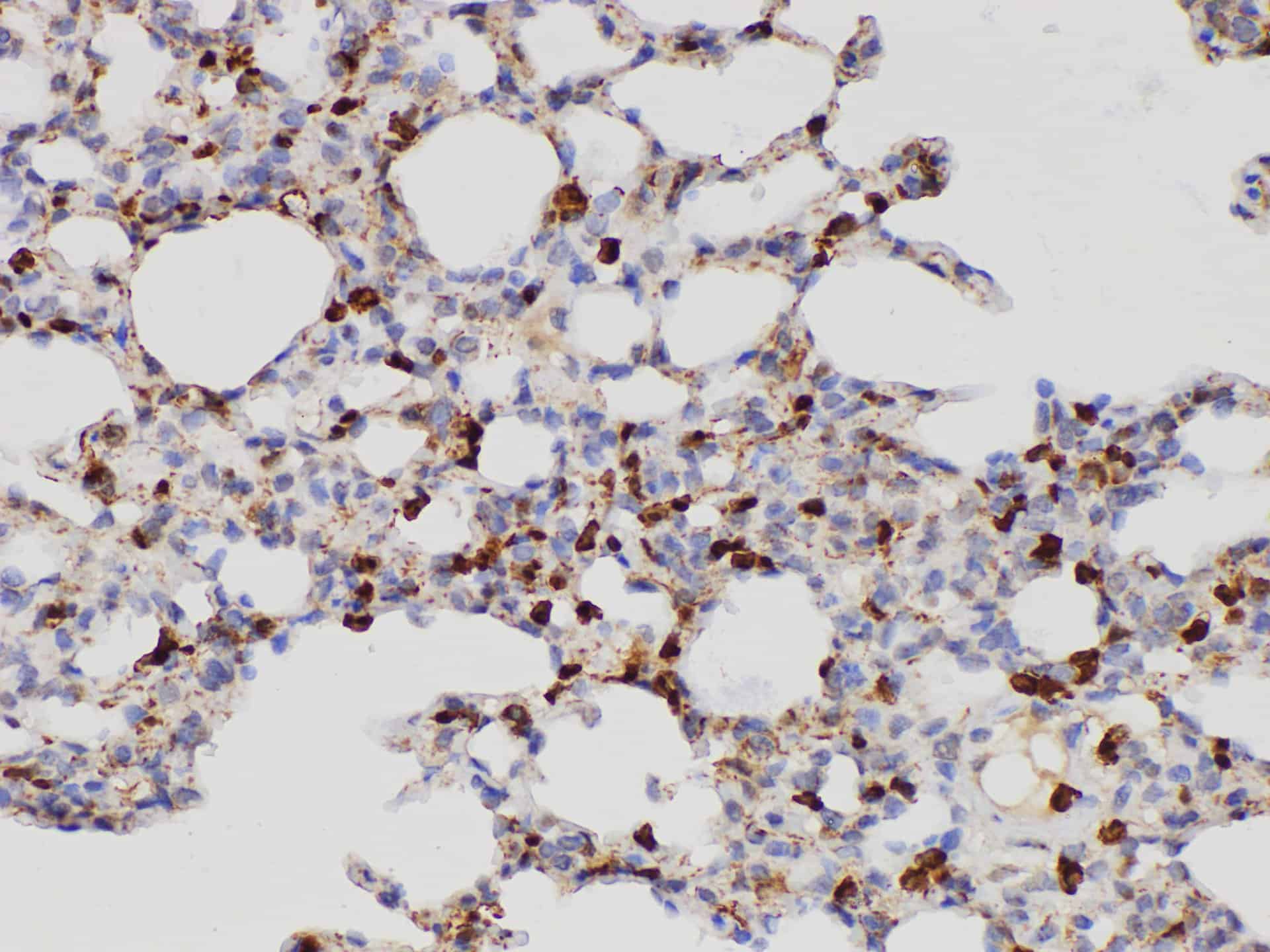 Purified Anti-Human CD48 Antibody[156-4H9]-产品推荐-1