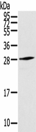 Western Blot analysis of Human fetal muscle tissue using THYN1 Polyclonal Antibody at dilution of 1/800