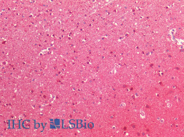 Immunohistochemistry of paraffin-embedded Human cerebral cortex using NEDD8 Polyclonal Antibody at dilution of 1:200(Elabscience Product Detected by Lifespan).