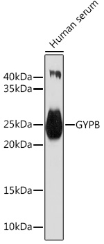 Western blot analysis of extracts of Human serum using GYPB Polyclonal Antibody at1:1000 dilution.