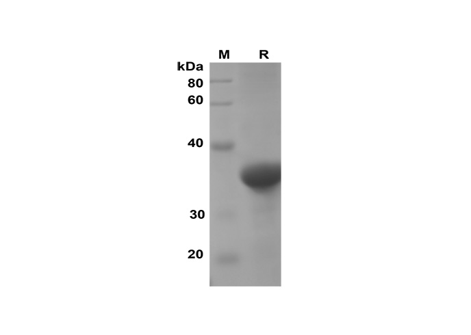 Recombinant Mouse IFN-γ Protein(GST Tag)-产品推荐-1