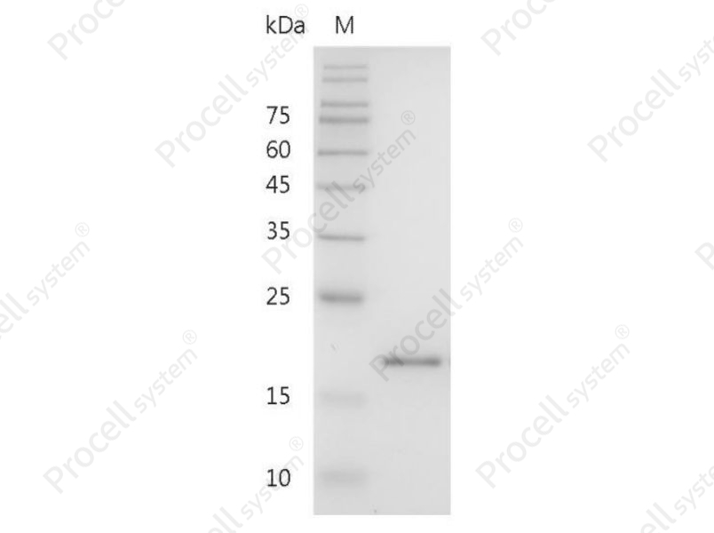 IL-36RA/IL-1F5/IL-1HY1/IL-1&delta;, Mouse, Recombinant